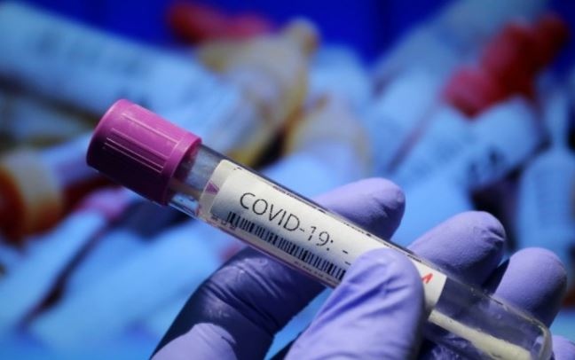 За последното денонощие у нас са регистрирани нови 845 заразени